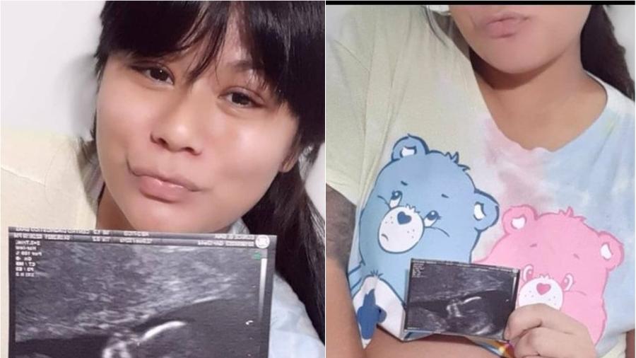 Eunice Baía anunciou gravidez nas redes sociais - Reprodução/Instagram