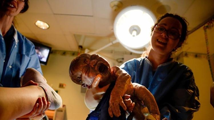 a fotógrafa Lauren Chenault fotografou o próprio parto - Divulgação/You're My Focus - Divulgação/You're My Focus