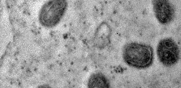 Fucruz registra imágenes de la replicación del virus de la viruela símica en una célula – 29/08/2022