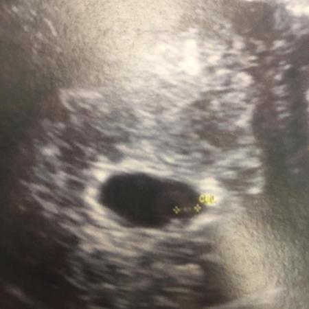 Ultrassom de Maria Gabrielli Machado mostrou pela primeira vez o filho que esperava - Reprodução/Instagram - Reprodução/Instagram