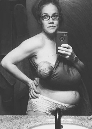 É assim que uma mulher fica após parir, diz - Reprodução/Instagram