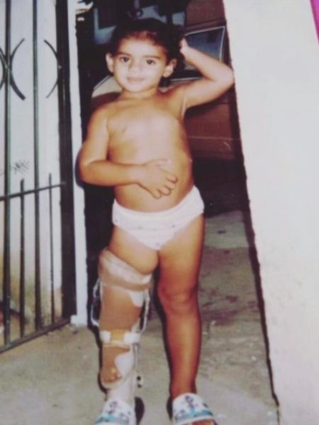 A paratleta Camille Rodrigues na infância - Reprodução/TV Globo - Reprodução/TV Globo