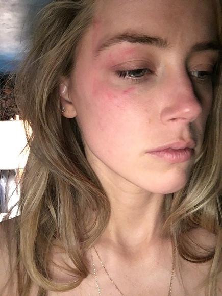 Amber Heard acusa Johnny Depp de violência doméstica - Reprodução/People