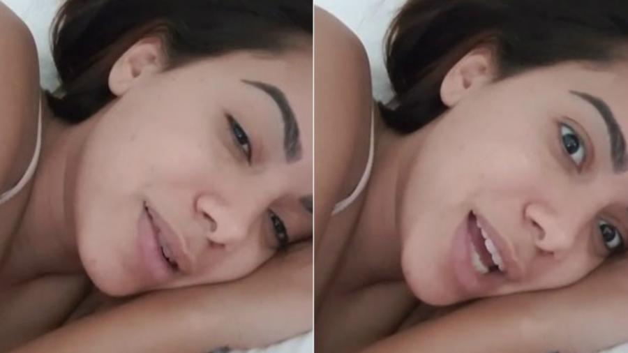 Em entrevista, Anitta fala sobre suas celulites: “Não acho bonito