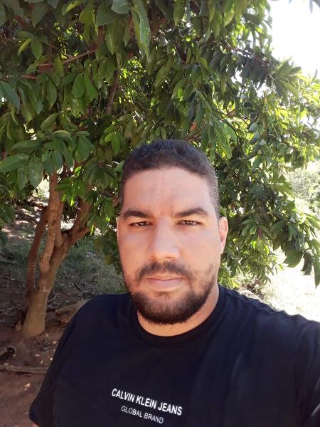 Marcus Vinicius Siqueira, 34, recebeu transplante de osso na canela