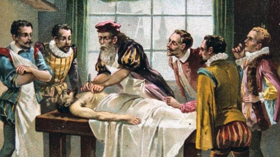 O médico militar francês do século 16 Ambroise Pare é considerado por muitos o pai da cirurgia moderna - Getty Images