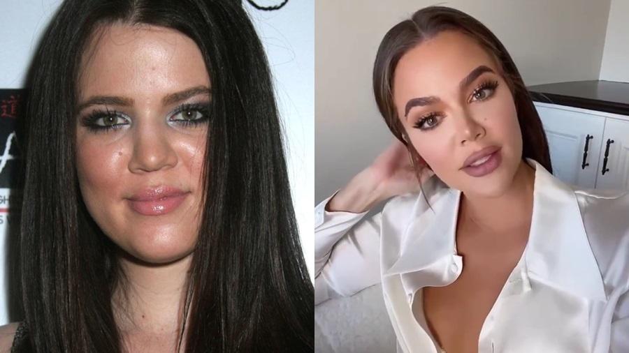 Khloé Kardashian antes e depois - Reprodução