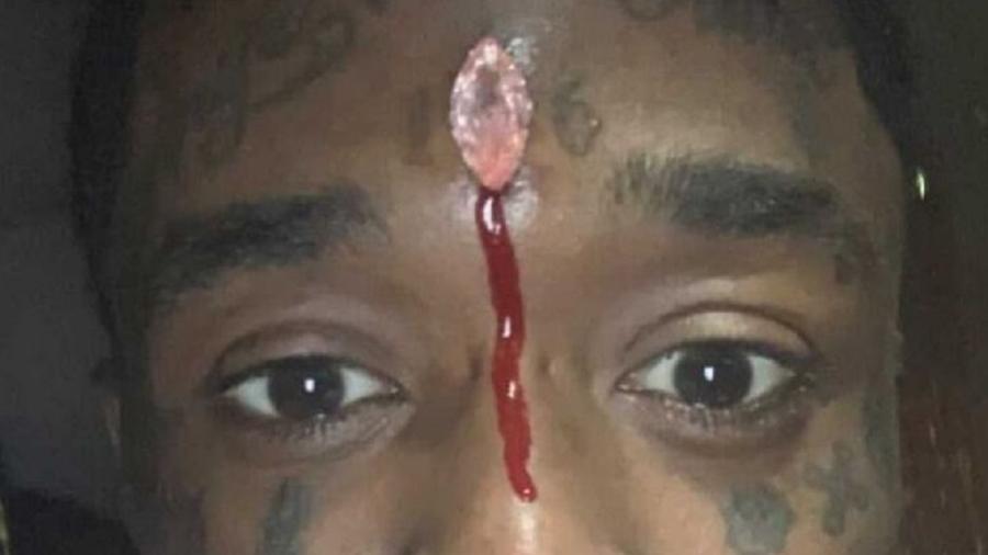 Lil Uzi Vert mostrou foto de diamante sangrando em sua testa, mas apagou em seguida - Reprodução/Twitter