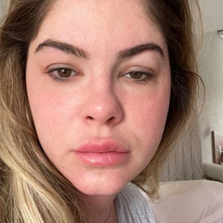 Bárbara Evans exibe rosto inchado por tratamento de fertilização - Reprodução/Instagram