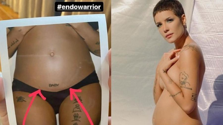 Halsey publica foto onde fala sobre sua luta contra a endometriose - Reprodução/Instagram