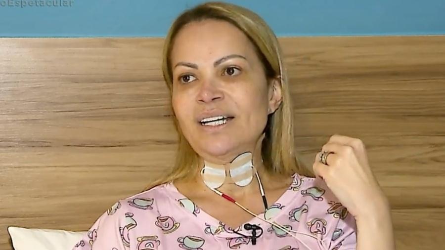 Solange Almeida está se tratando após vício em cigarro eletrônico