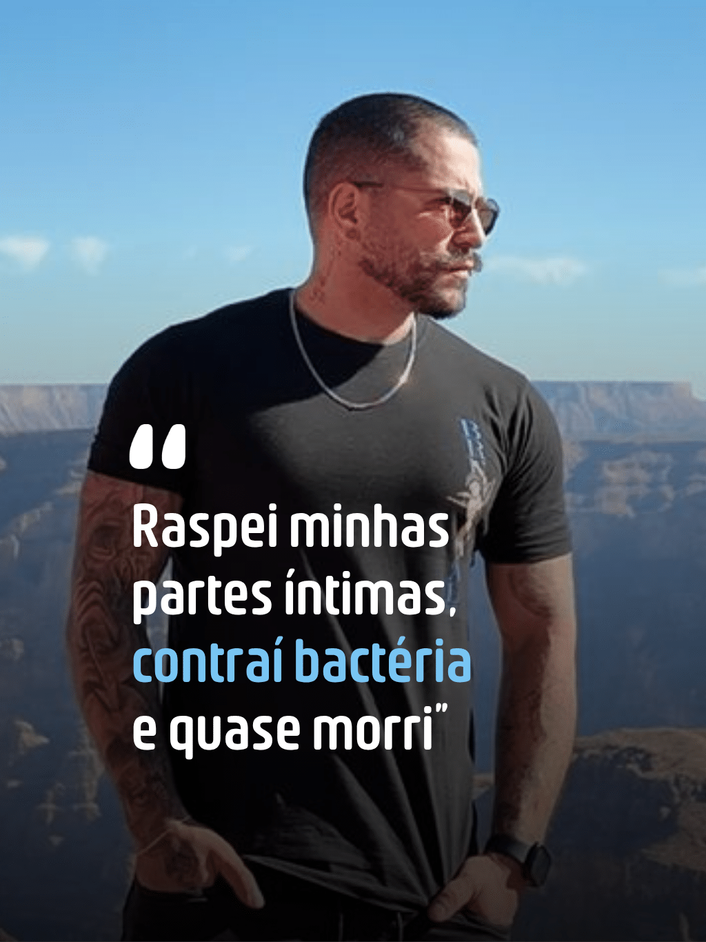 'Raspei minhas partes íntimas, contraí bactéria e quase morri'