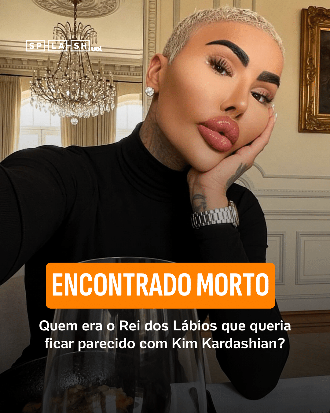 Encontrado morto: quem era o Rei dos Lábios que queria ficar parecido com Kim Kardashian?