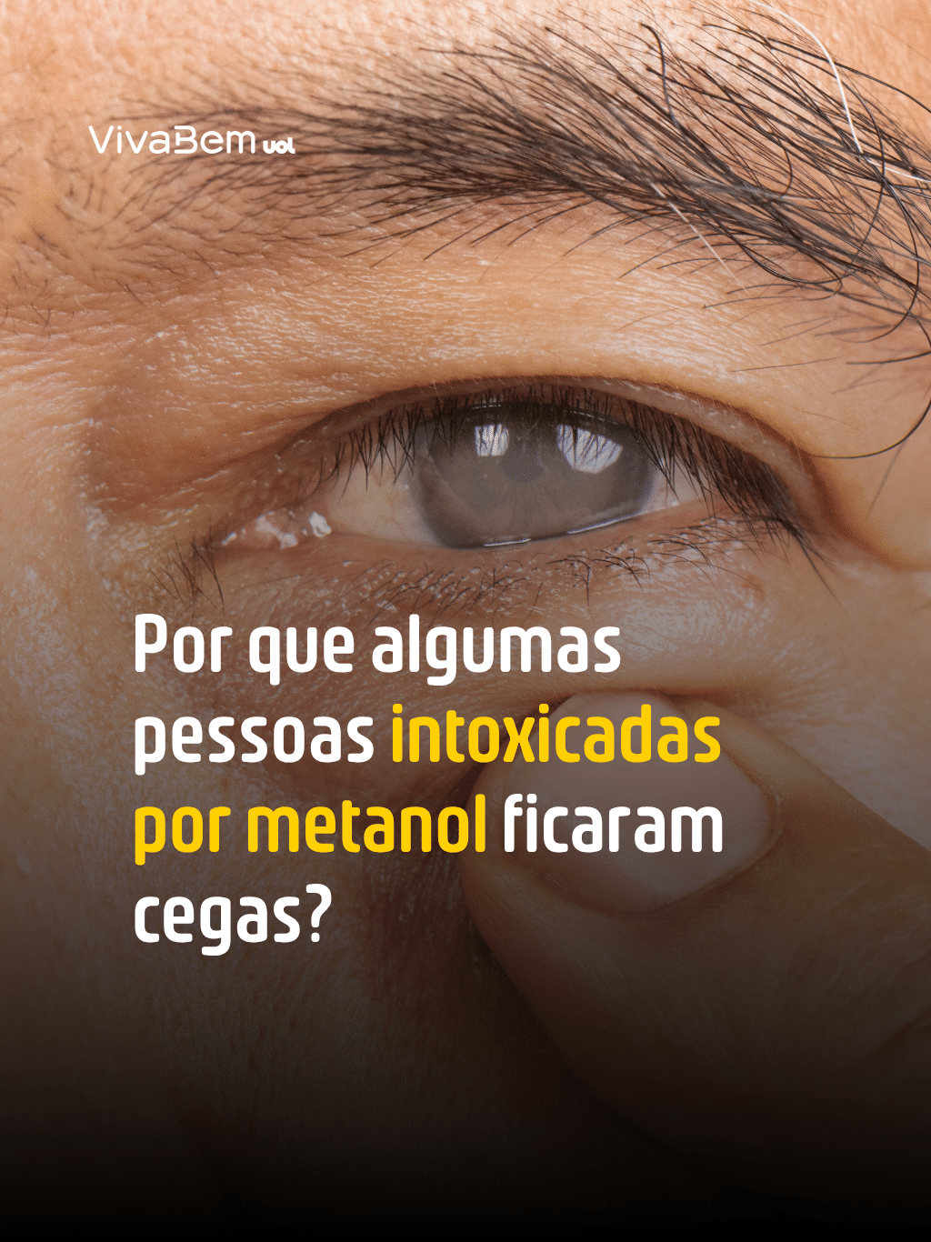Por que algumas pessoas intoxicadas por metanol ficaram cegas?
