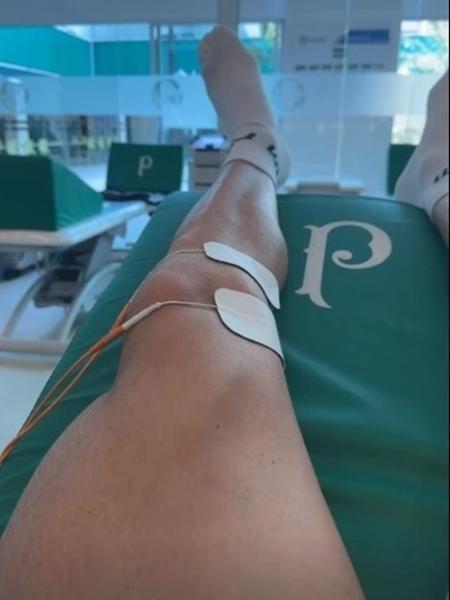 Piquerez publicou nas redes sociais uma foto fazendo tratamento no joelho