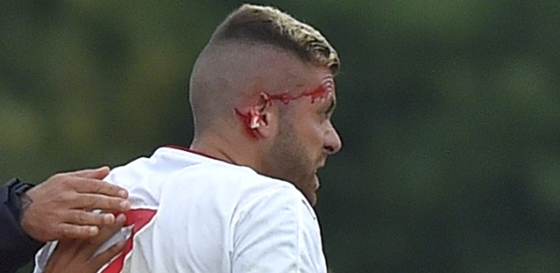 Menez reclama depois de ter parte da orelha arrancada em pisão - AFP PHOTO / LOIC VENANCE