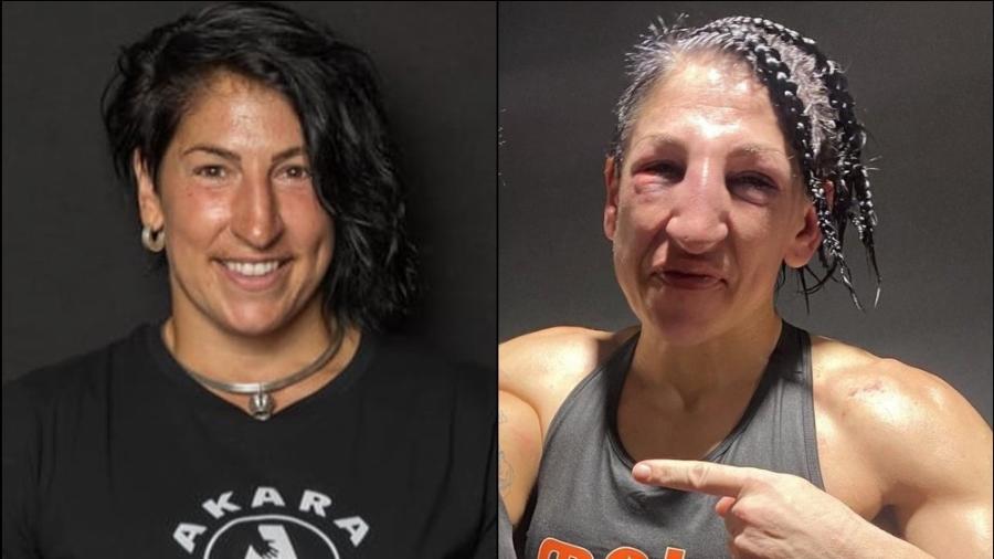 Miriam Gutiérrez, lutadora de boxe, ficou irreconhecível após derrota contra Amanda Serrano - Reprodução/Instagram