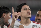 Mauro Cezar: Flamengo tem tudo para ser campeão; é só ter o mínimo cuidado