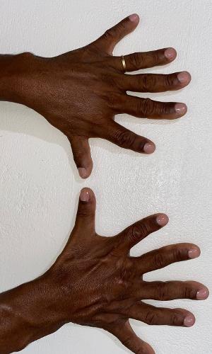 Josevaldo, torcedor baiano da seleção, mostra os seis dedos em cada mão