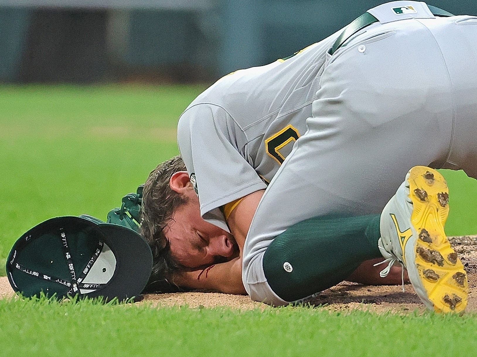 Nos EUA, jogador de beisebol é atingido na cabeça por bola a quase