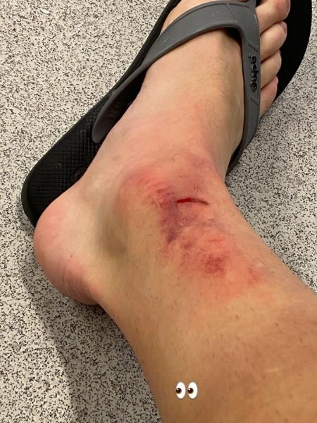Carlos Augusto postou foto de tornozelo machucado após vitória sobre o Mirassol - Reprodução
