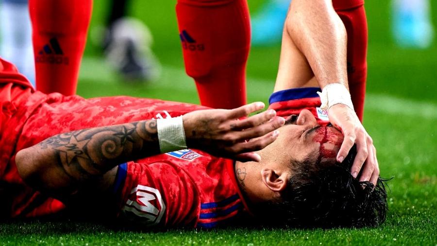 Lucas Paquetá, do Olympique Lyon, sangra após bater a cabeça em Pepe, do Porto - Quality Sport Images/Getty Images