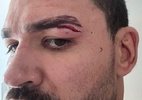 Briga entre equipes gera cancelamento de luta principal do Karate Combat