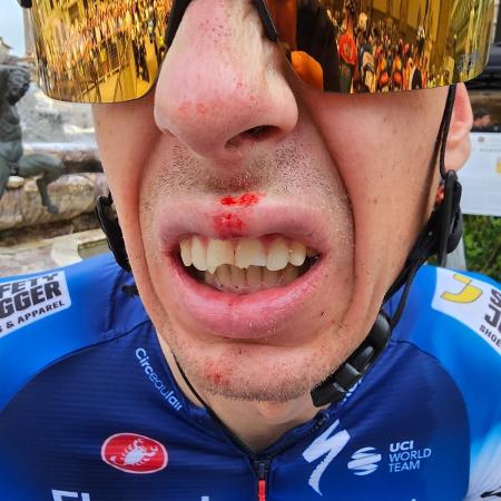 Ciclista tcheco Jan Hirt quebra três dentes antes da largada do Tour de France - Reprodução/X