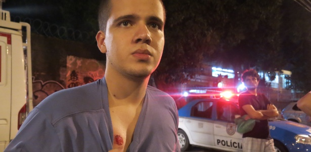 Estudante Fernando Matos mostra marca de tiro levado em manifestação