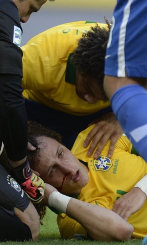 19.06.13 - Nariz de David Luiz começa a sangrar após zagueiro se chocar com a cabeça de Thiago Silva