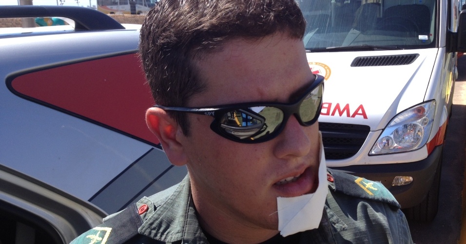 19.jun.2013 - Policial recebe curativo no rosto após ficar ferido em confronto com manifestantes em Fortaleza