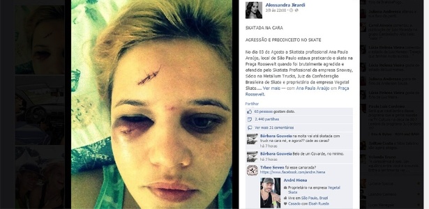 Ana Paula Araújo mostra ferimentos no rosto após ser agredida na praça Roosevelt - Reprodução/Facebook