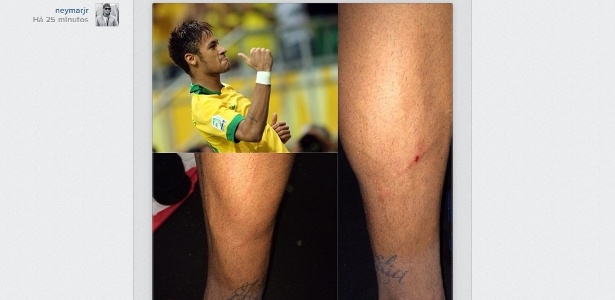 Neymar postou no Instagram foto das marcas de sua canela após partida contra Honduras