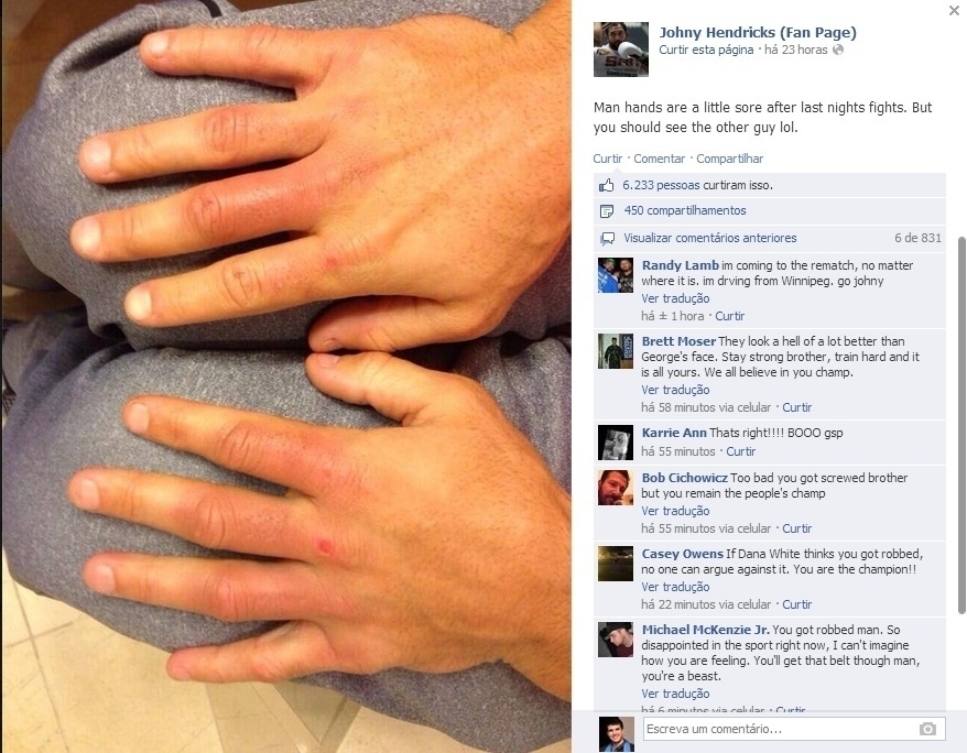 Johny Hendricks mostra como ficaram suas mãos após a derrota contra GSP no UFC 167 - Reprodução/Facebook