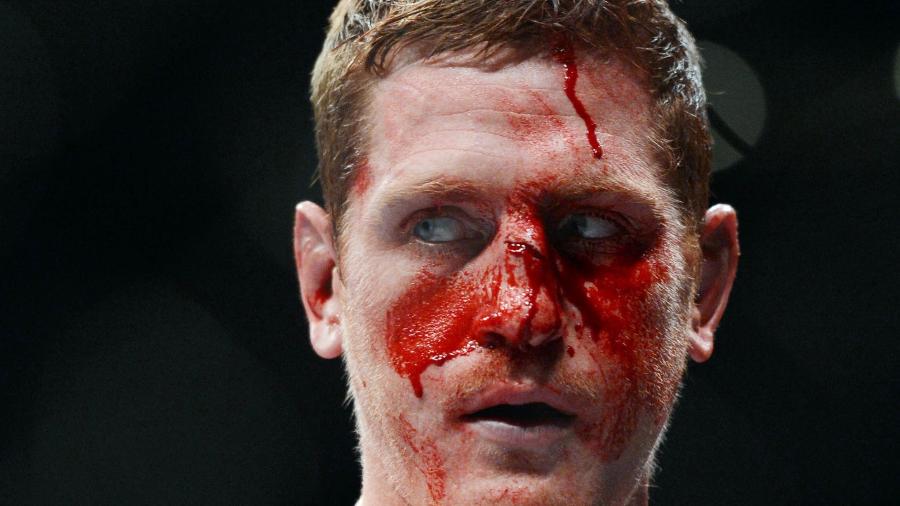 15.dez.2013 - Mac Danzig fica com o rosto sangrando após luta com  Joe Lauzon, no UFC on Fox 9 - Kyle Terada/USA TODAY