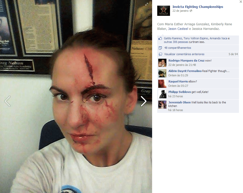 24.jan.2014 - Kaitlin Young, lutadora de MMA, sofre lesão durante treinamento