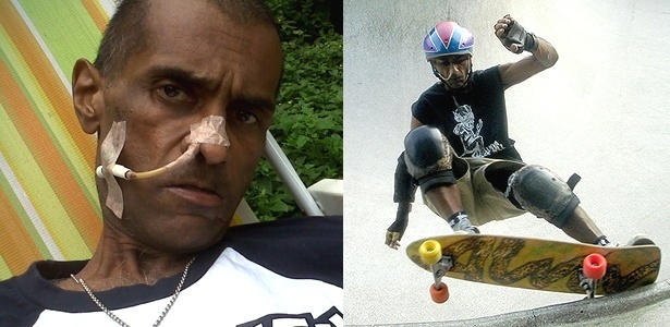 Bruno Leonardo superou o câncer e voltou a andar de skate - Arquivo pessoal
