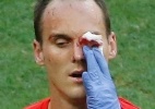 Com lesão no olho, zagueiro suíço está fora da Copa do Mundo - REUTERS/Fabrizio Bensch