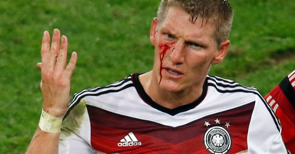 Schweinsteiger sofre corte no olho após soco de Aguero na final da Copa do Mundo