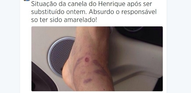 Dirigente do Cruzeiro posta foto da canela do volante Henrique após entrada de Emerson Sheik - Reprodução/Twitter