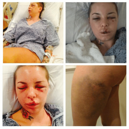 Atriz pornô Christy Mack divulgou fotos de seu estado após o ocorrido, em 2014 - Reprodução/Twitter