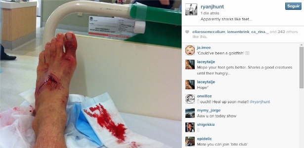 Surfista posta foto de pé após ser mordido por tubarão - Reprodução / Instagram