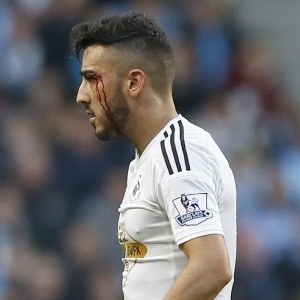 Neil Taylor, jogador do Swansea, sai de campo com sangramento no supercílio durante derrota para o Manchester City - undefined