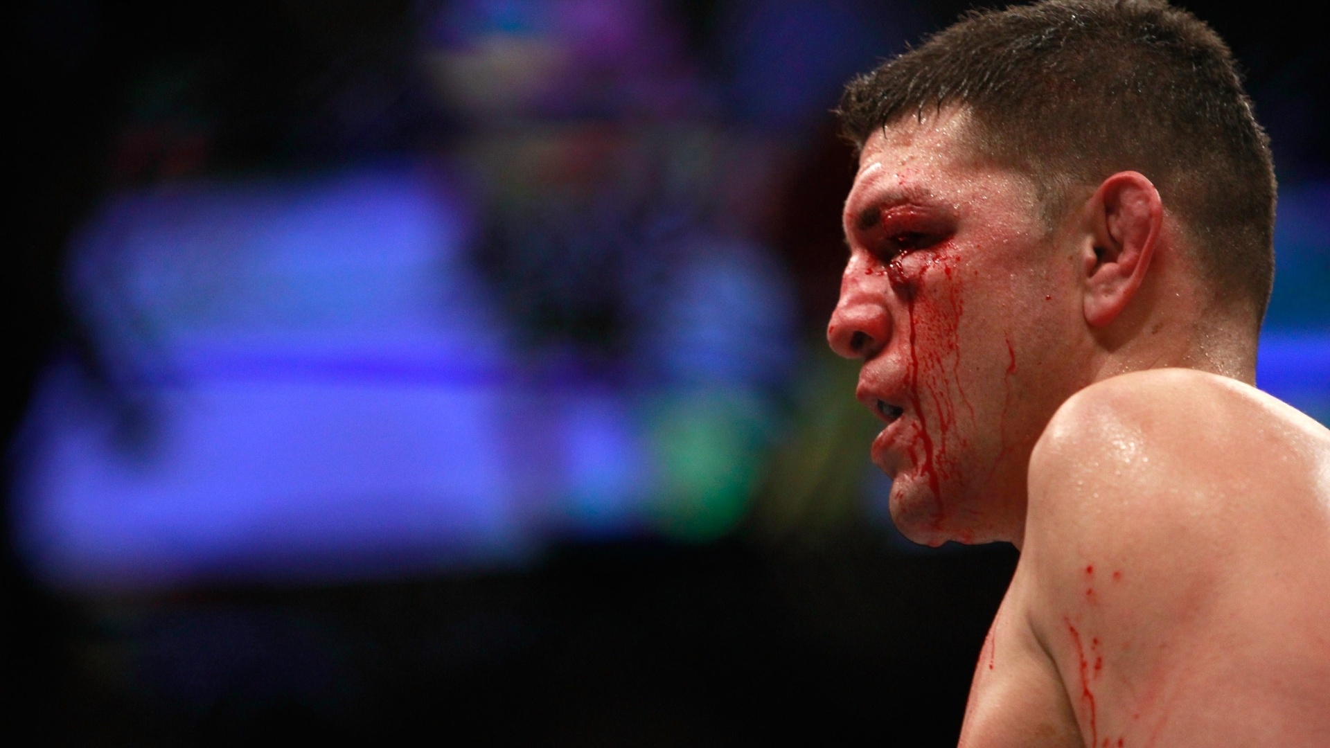 Nick Diaz deixou o octógono com o rosto castigado após perder para Anderson Silva na luta principal do UFC 183 em Las Vegas