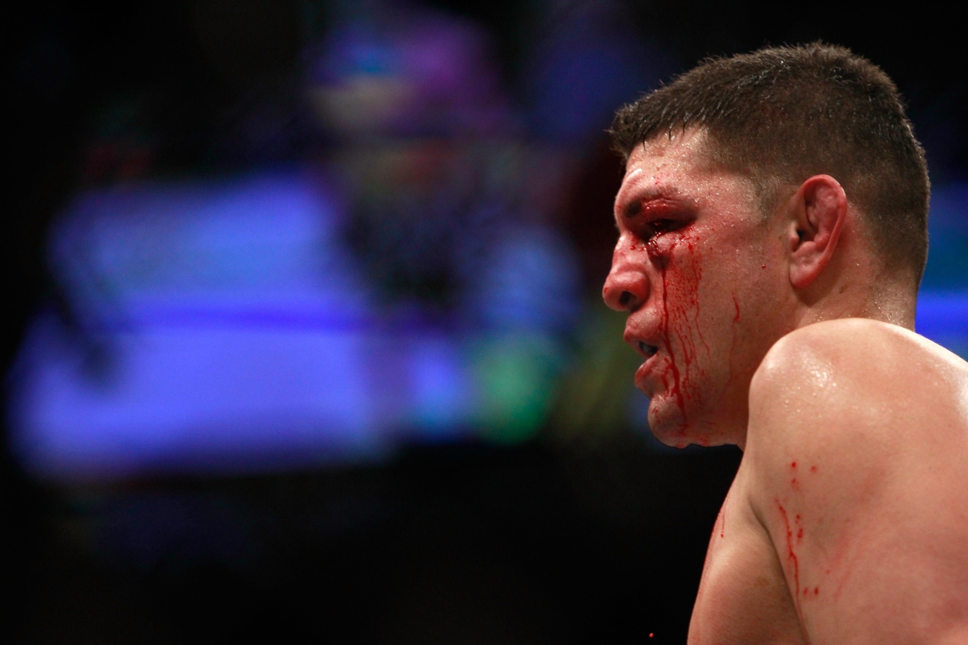 Nick Diaz deixou o octógono com o rosto castigado após perder para Anderson Silva na luta principal do UFC 183 em Las Vegas - Steve Marcus/Getty Images/AFP