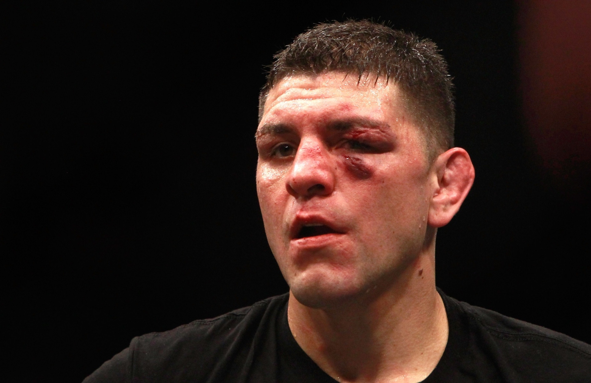 Nick Diaz foi derrotado por Anderson Silva na luta principal do UFC 183 e deixou o octógono com o rosto machucado - Steve Marcus/Getty Images/AFP
