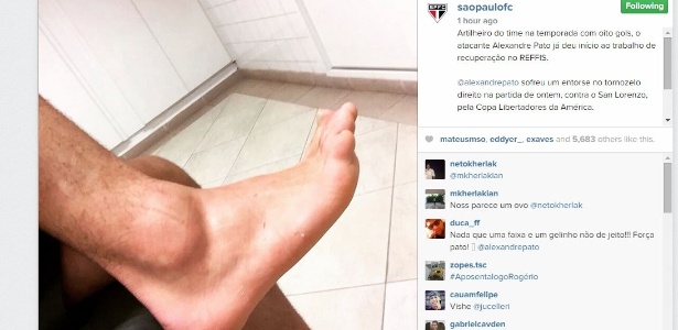 Tornozelo de Pato aparece inchado após torção - Reprodução/Instagram