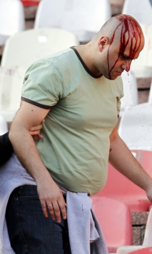 Detalhe de torcedor com a cabeça sangrando após briga de torcida no clássico entre Estrela Vermelha e Partizan, em Belgrado, na Sérvia