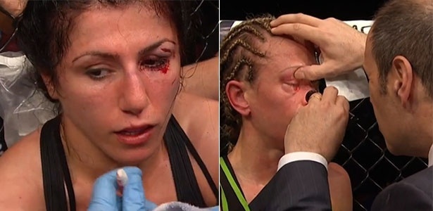 Randa Markos e Jessica Rakoczy ficaram com olhos machucados - Reprodução/Combate