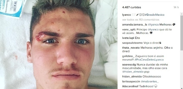 O jogador do São Paulo publicou a imagem em seu Instagram após a partida  - Reprodução/Instragram